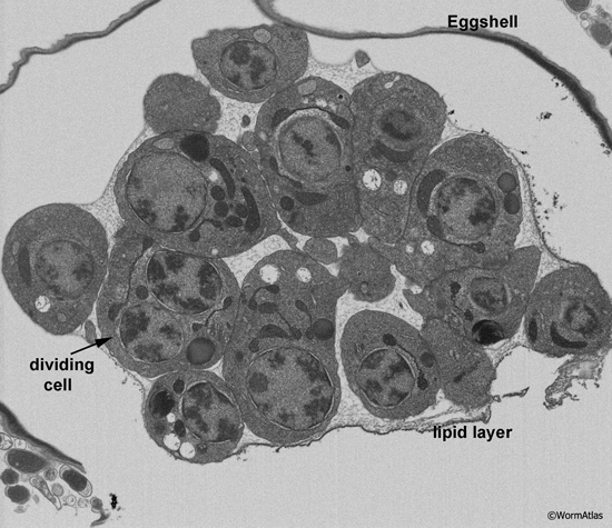 EMFIBSEMFIG 2: FIB/SEM imaging. 